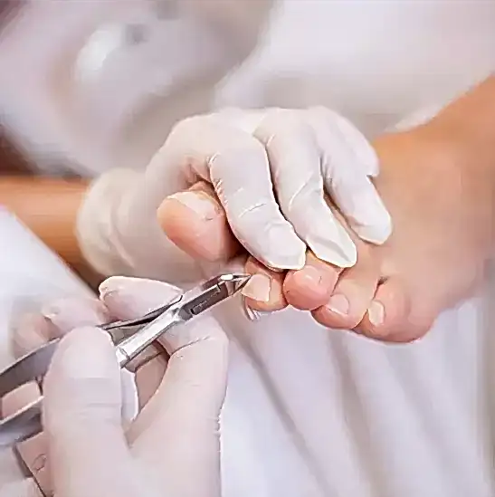 Batık Tırnak Bakımı